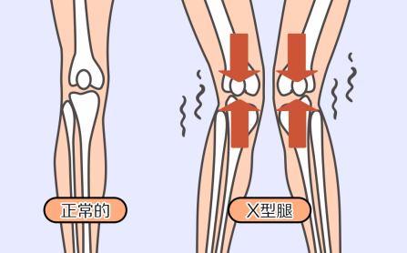 爸妈腿疼怎么办,妈妈总是腿疼关节疼