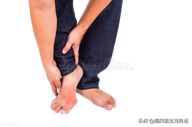 痛风备孕能吃什么药,高尿酸吃药期间能备孕吗