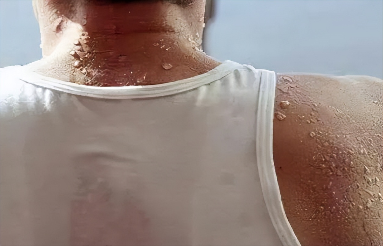 到了夏天总是疲乏无力是怎么回事,夏天出汗太多浑身没劲肌肉痛