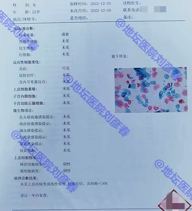 为什么tct正常而活检有癌前病变,为什么tct异常不会显示宫颈炎