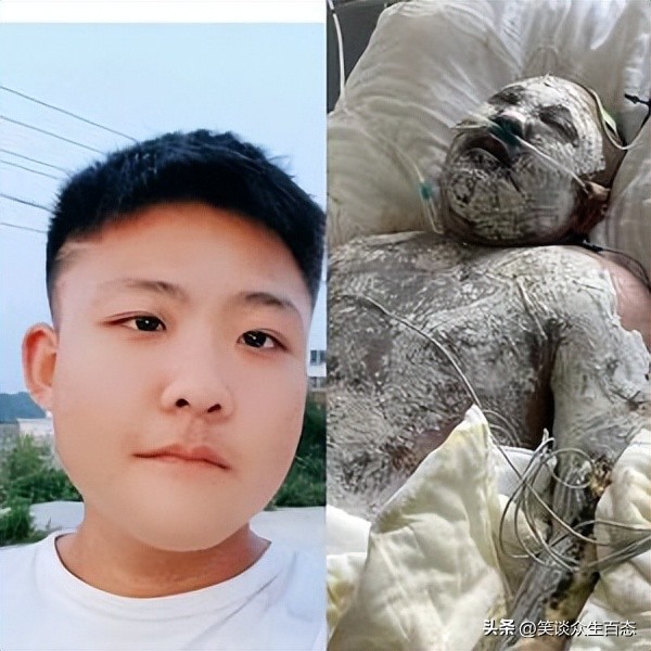 乌金山摩托车事故后续,乌金山摩托事故