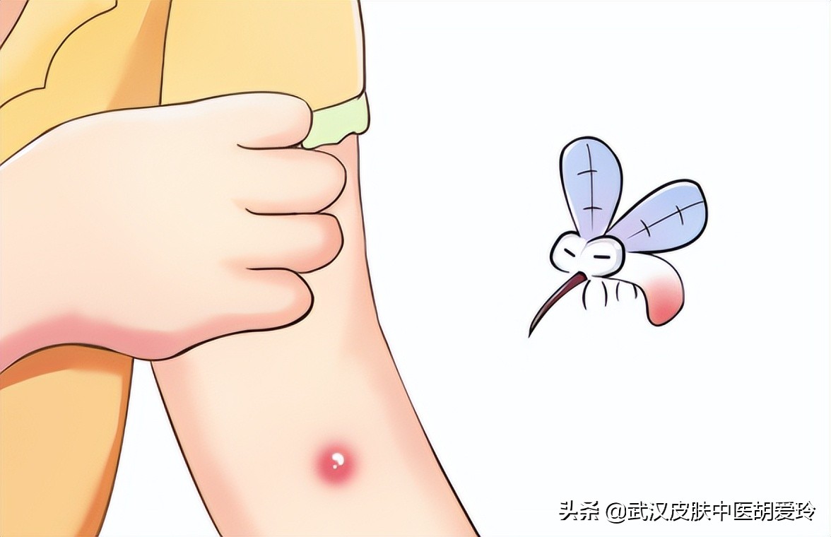 浑身痒怎么办特别是在晚上,晚上身上起疙瘩很痒像蚊子叮的包