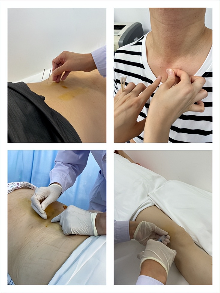 市中医院推拿针灸门诊部,五院康复理疗大厅