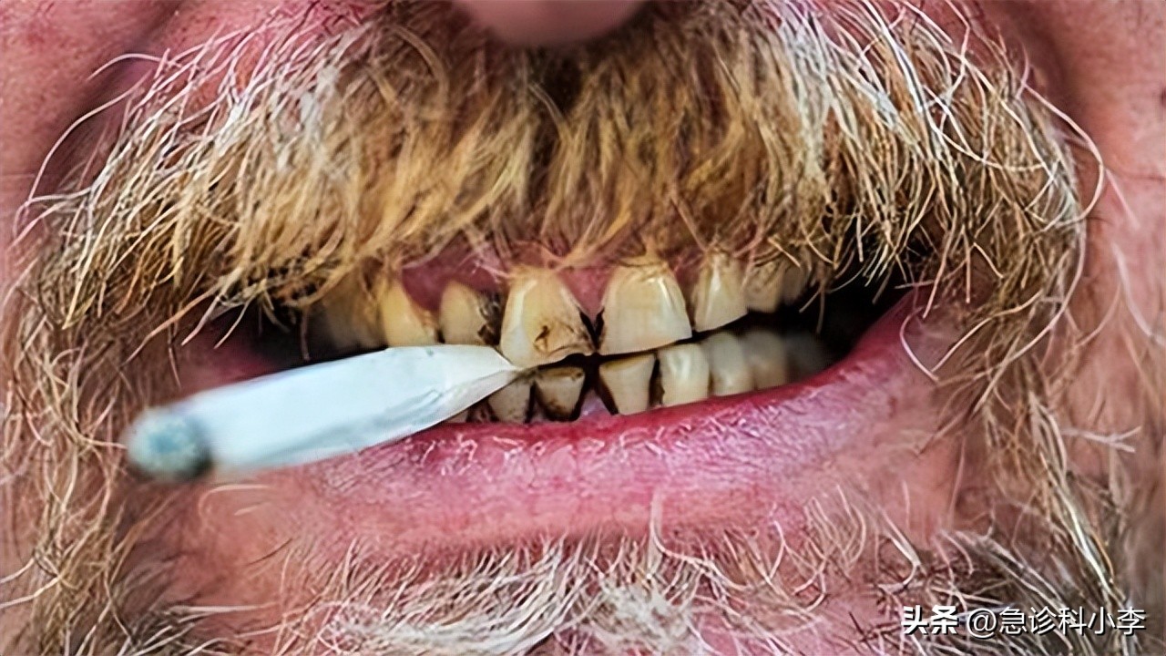 酒瘾烟瘾和毒瘾,酒瘾烟瘾哪个危害更大