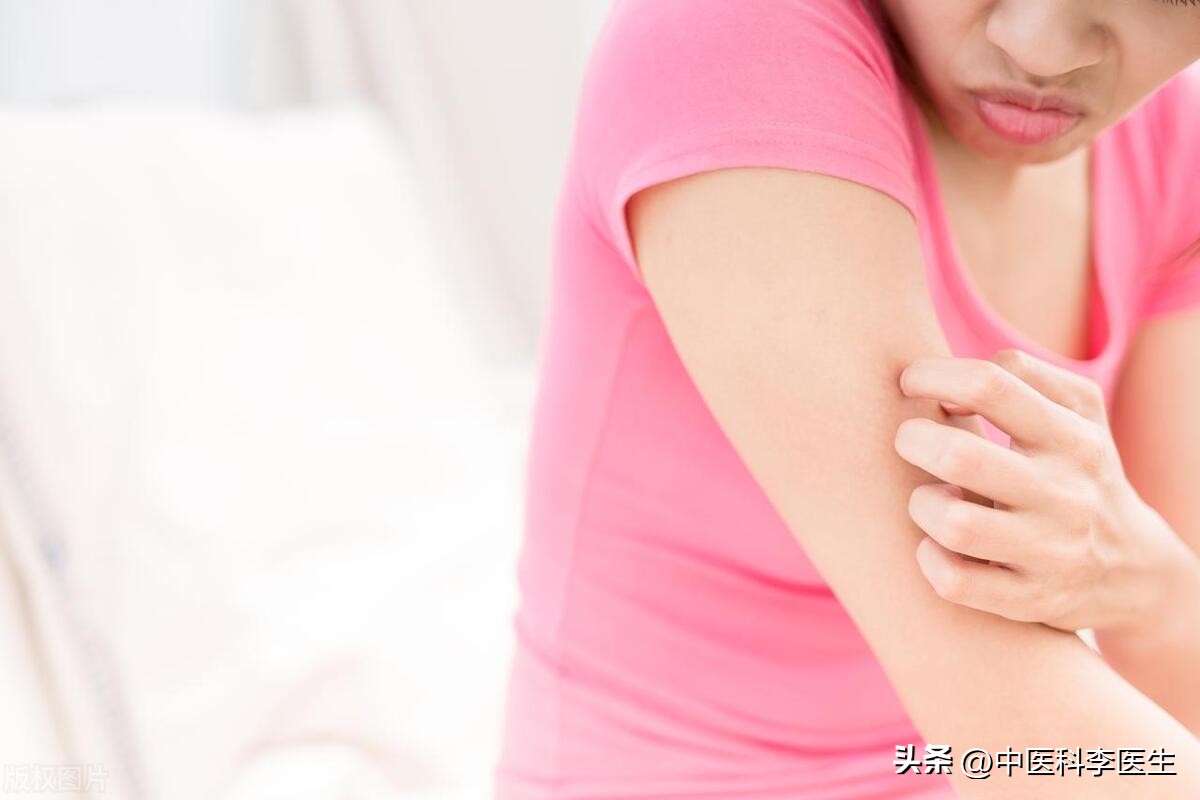 下体瘙痒发现两三只阴虱严重吗,阴部有几十只阴虱