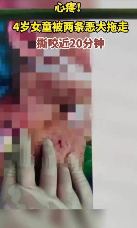 回顾贵州老人山上晨练，被杜高犬一路跟随，最终被2只杜高犬撕碎