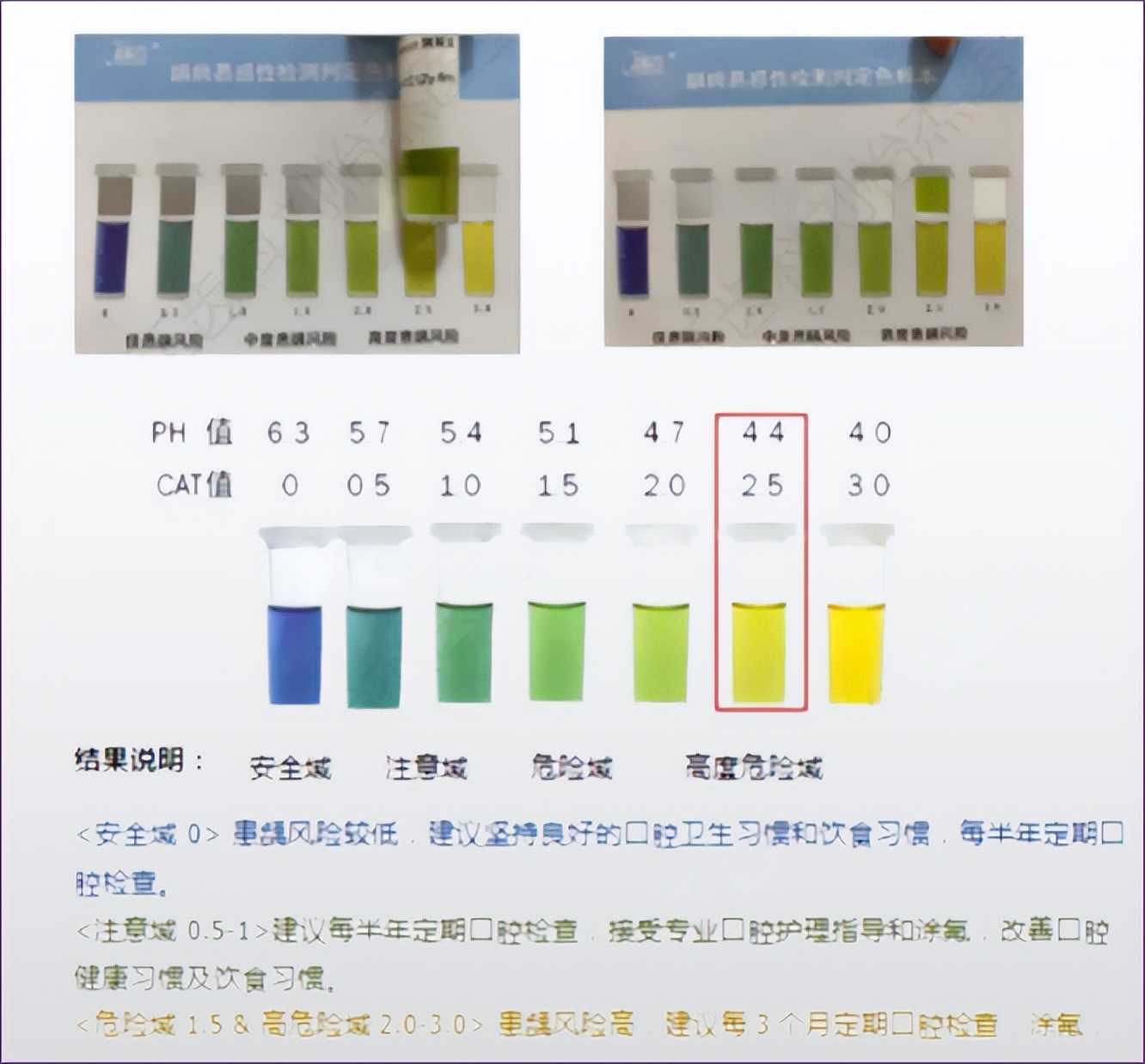 门牙缝龋齿怎么治疗,3岁门牙龋齿怎么补