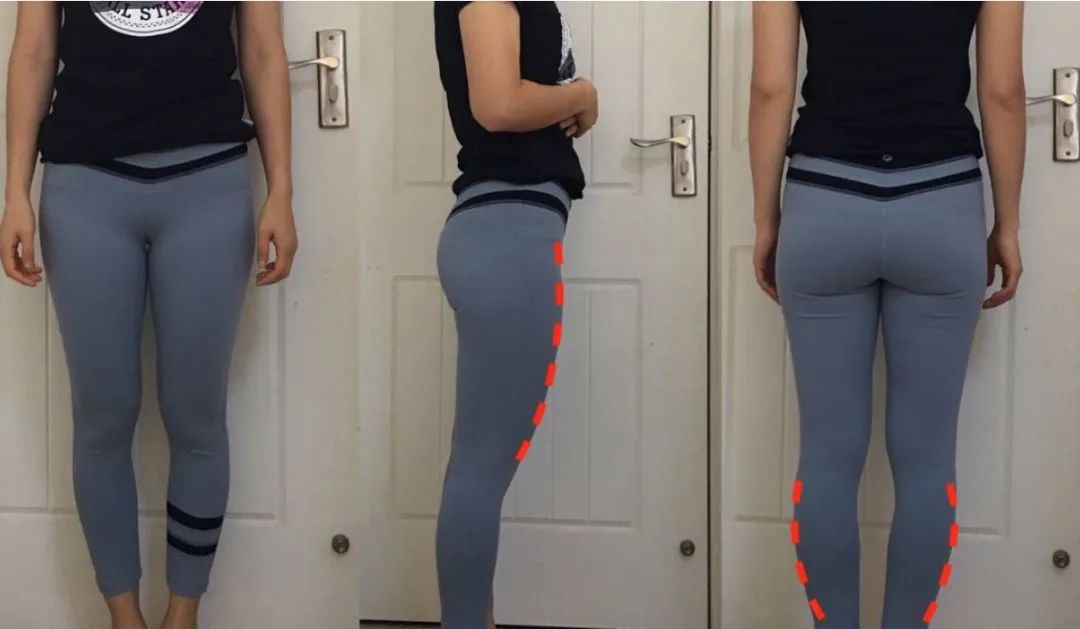 拉筋板真的会瘦肌肉小腿么,拉筋板真的可以瘦哪里