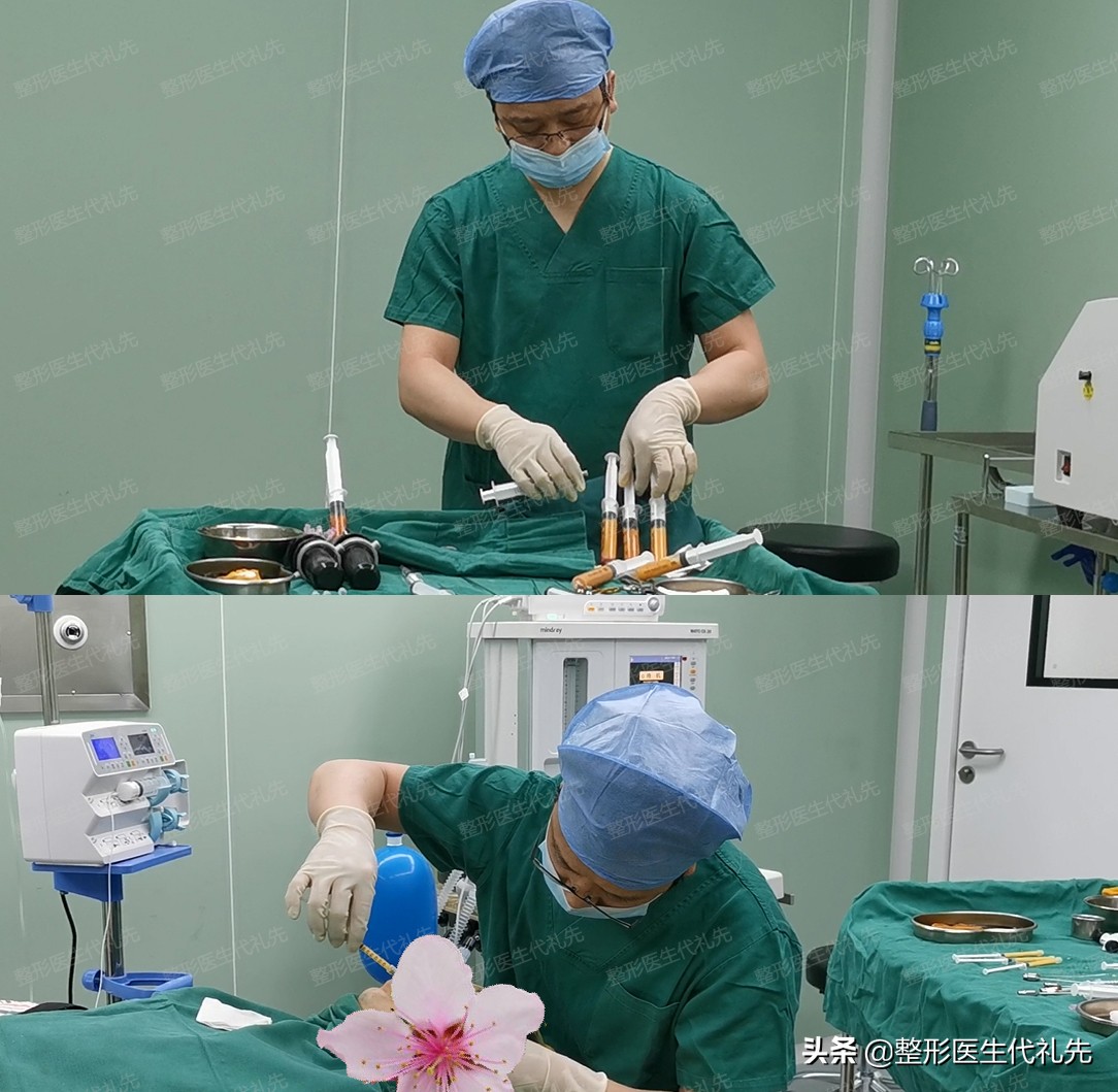 面部凹陷可以通过什么医美改善,面部整形面部凹陷怎么修复