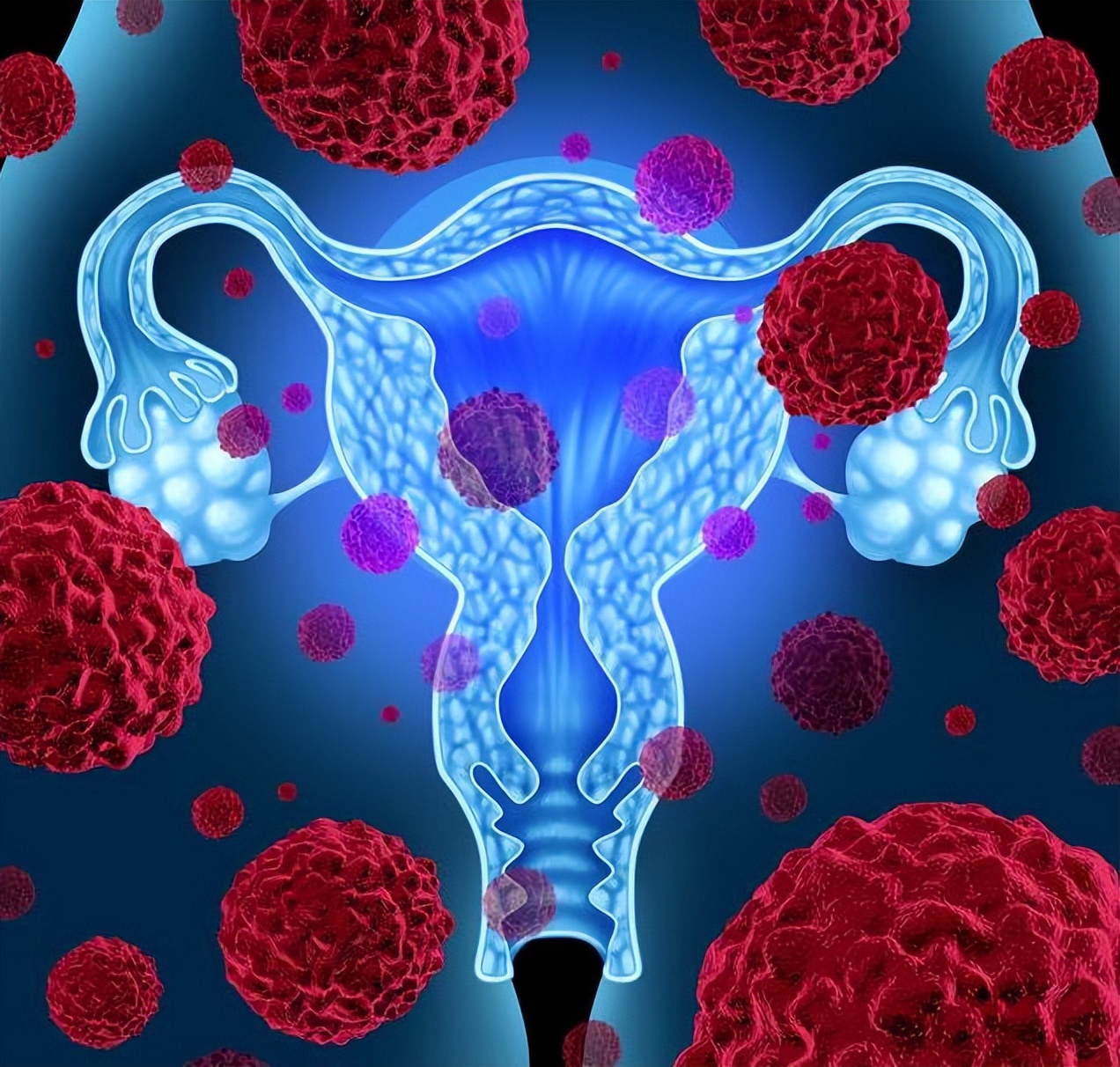 一年间体检查出宫颈癌是晚期,20岁宫颈癌是什么原因引起的