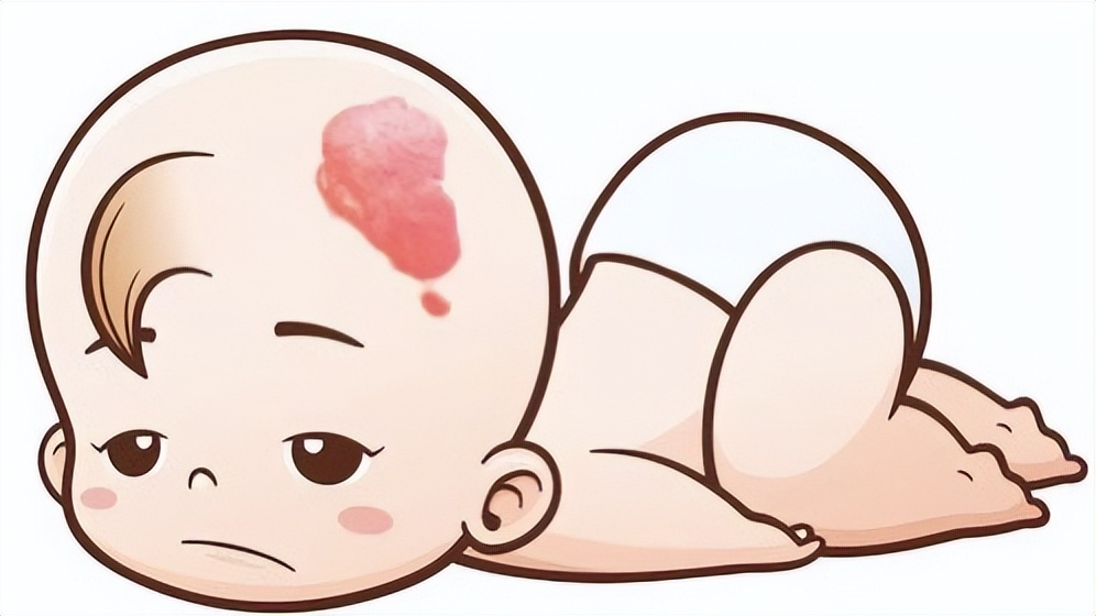 孩子颈部鼓起一个硬包图片,小孩颈部有鼓包颜色变重
