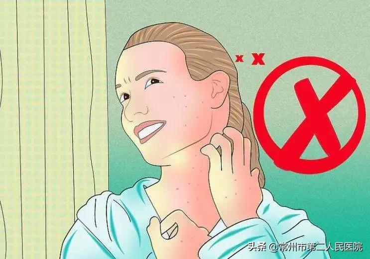 手脚发痒难受长红疙瘩特别是晚上,一到晚上手脚就痒用什么药