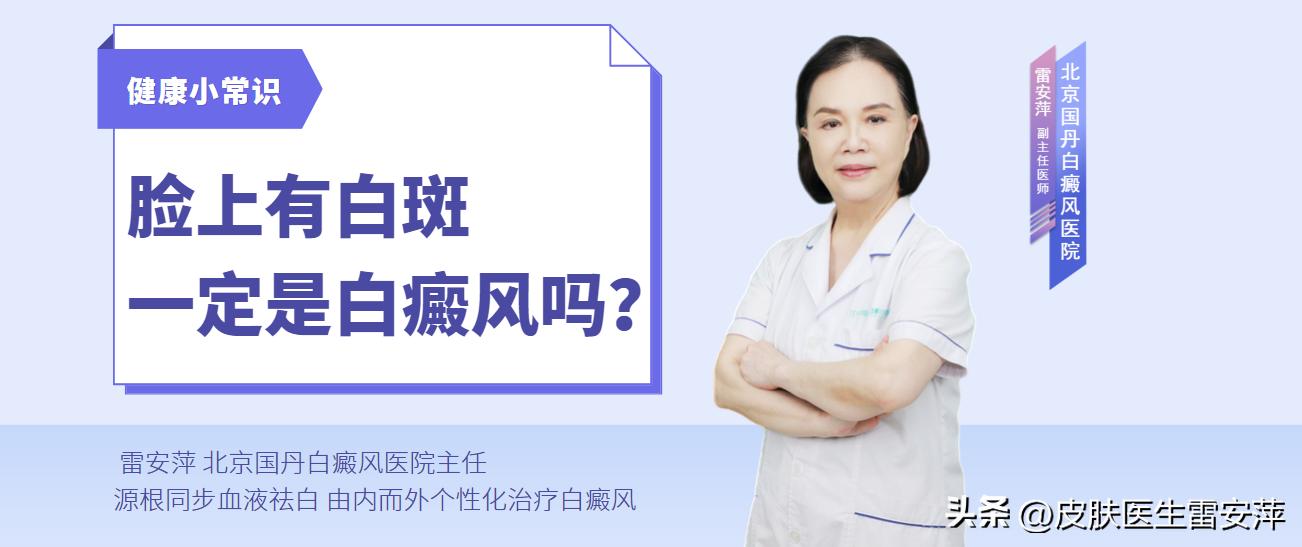 孩子脸上白斑如何与白癜风鉴别,白癜风初期症状是不是白斑在脸上