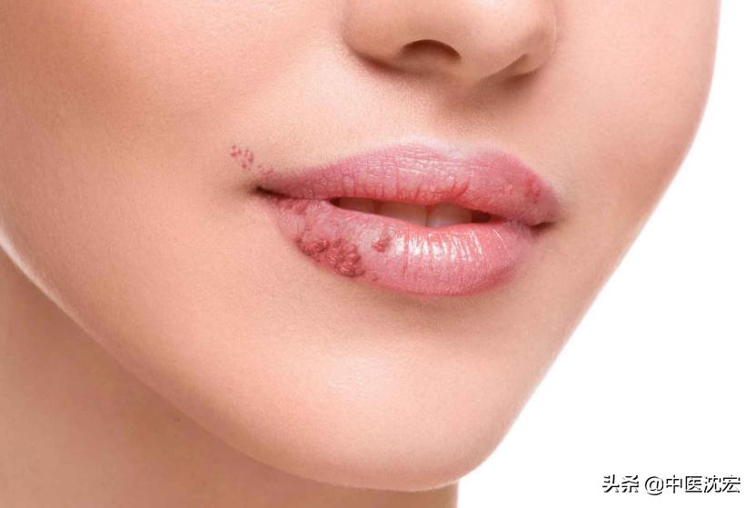 脾胃虚弱跟嘴唇有关系吗,脾胃虚怎么看得出来