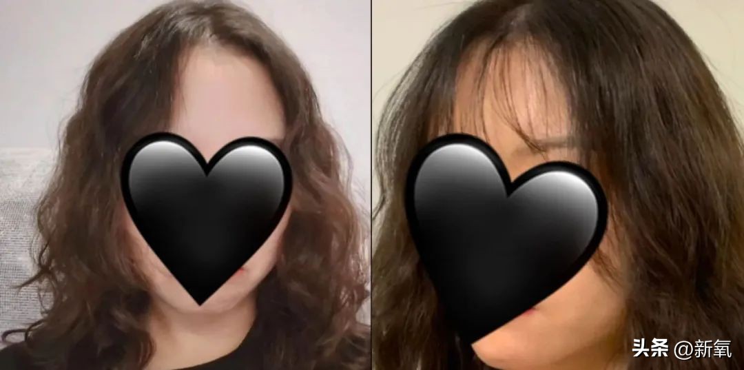 24岁媚眼如丝恋爱脑，10年后帅过前任，她情丝和头发一起斩断了？