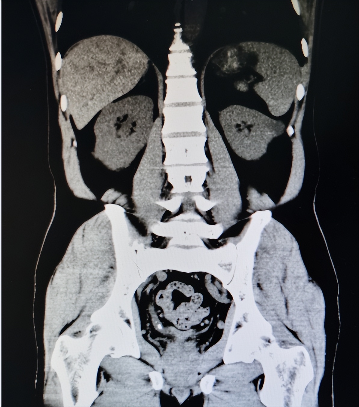 尿频尿痛是尿道炎吗,尿频尿痛肾阴虚还是肾阳虚