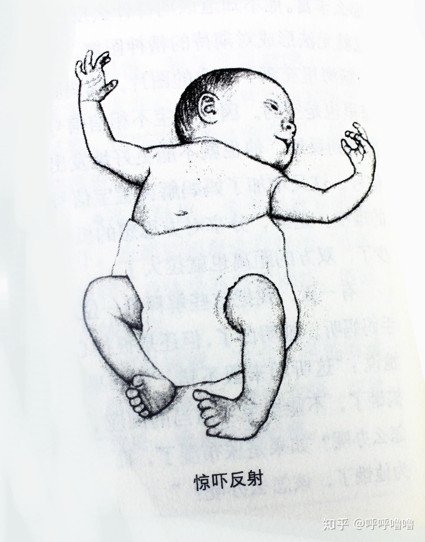 宝宝侧睡没有惊跳反射平躺就有,刚满月宝宝频繁的惊跳醒怎么回事