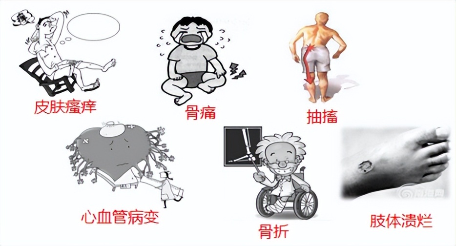 高磷血症最常见的全身症状,肾病患者钾高磷高饮食应注意什么