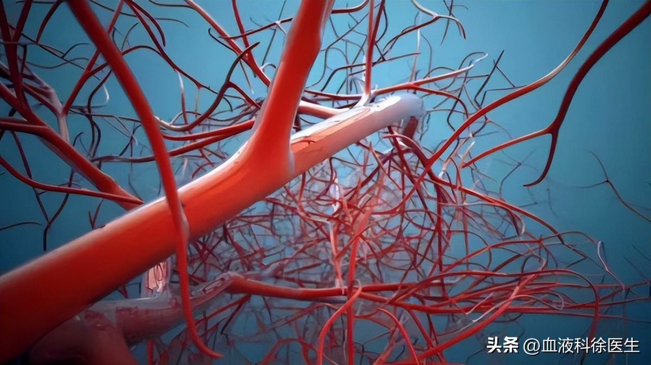 血栓来临，手脚先知！医生提醒：手脚出现3大症状，需警惕血栓