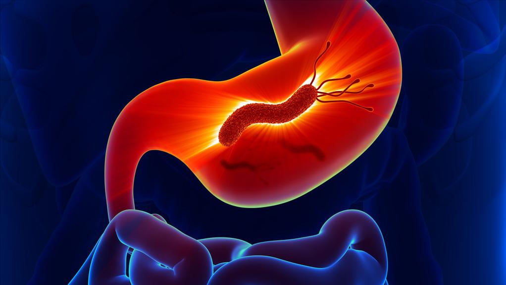 幽门螺旋杆菌阳性dpm值1145严重吗,幽门螺旋杆菌阳性值为00340严重吗