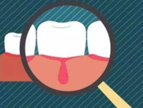 电动牙刷的利与弊总结,电动牙刷刷牙的弊端