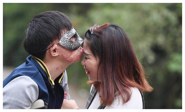 新郎救火时毁容新娘依然嫁给了他,新郎被烧伤新娘前往医院