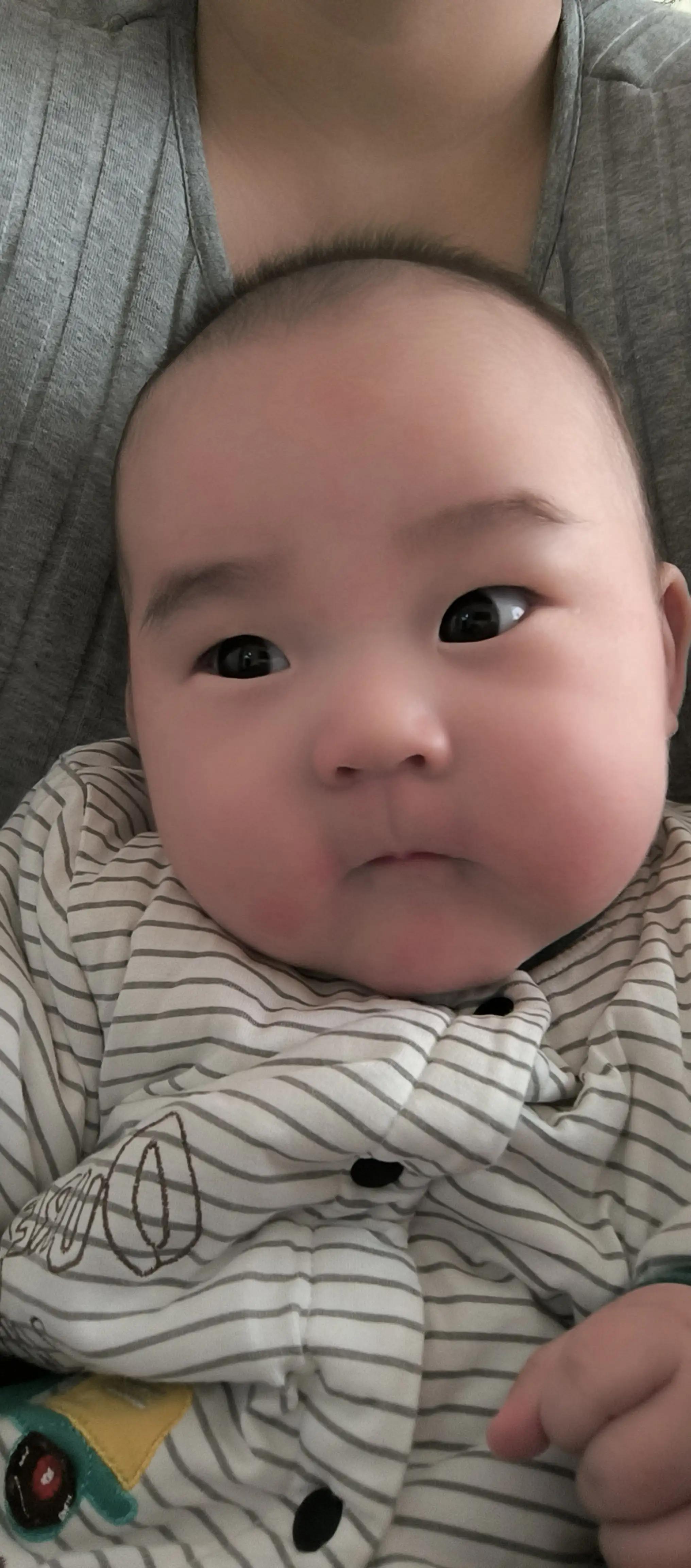 多年的湿疹自愈了,治好湿疹的经历