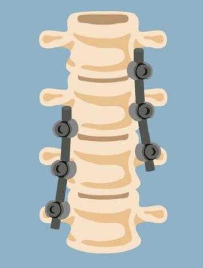 腰椎间盘突出可以练瑜伽吗,腰椎间盘突出可以骑自行车吗