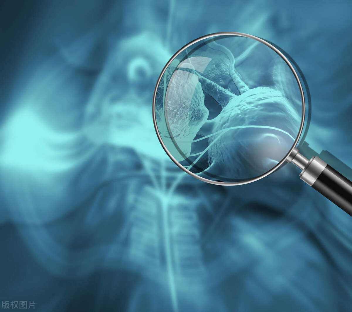 一夜过来手指变杵状指是不是肺癌,杵状指是肺癌的前兆吗