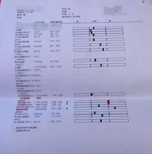 猫咪乳腺炎需要把奶挤出来么,猫咪假孕乳腺炎有硬块怎么消除