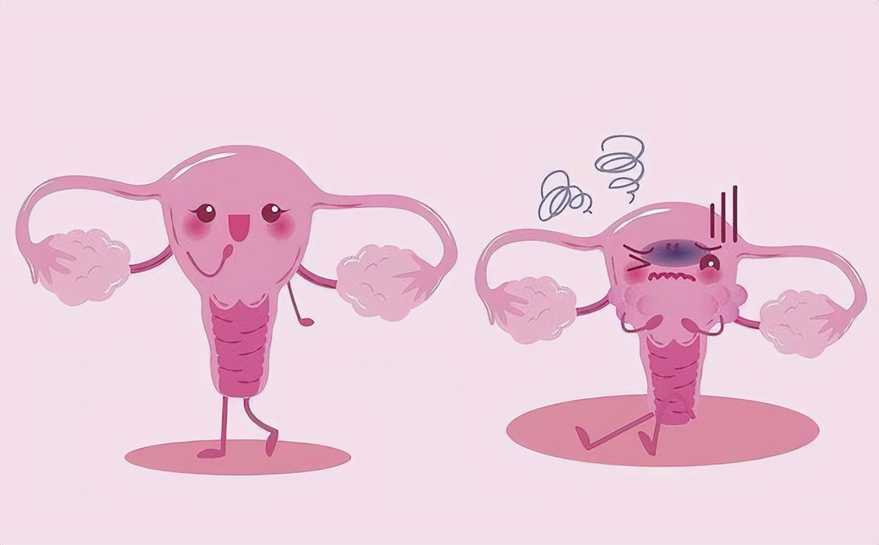 为什么日本女性很少得妇科病？医生：或与这4种生活习惯有关系