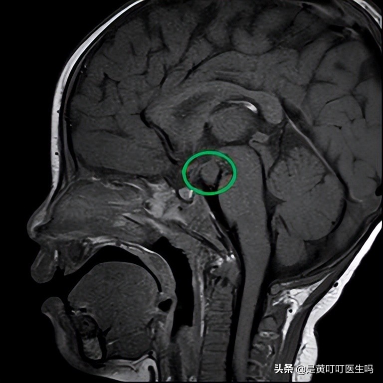 健康科普女生,科普女性健康体检