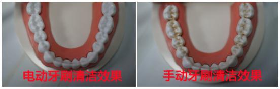 戴牙套用普通牙刷好还是电动,戴牙套用电动牙刷好还是手动好