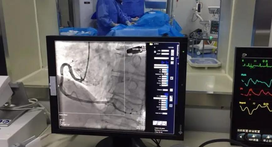 做完冠脉造影，病人就活不久了？冠脉造影检查对人体有什么危害？