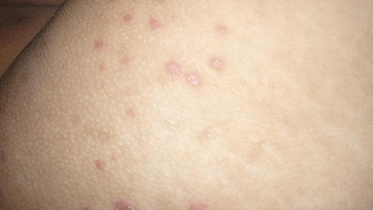 凌霄花可治癌,凌霄花可以治疗癌症吗