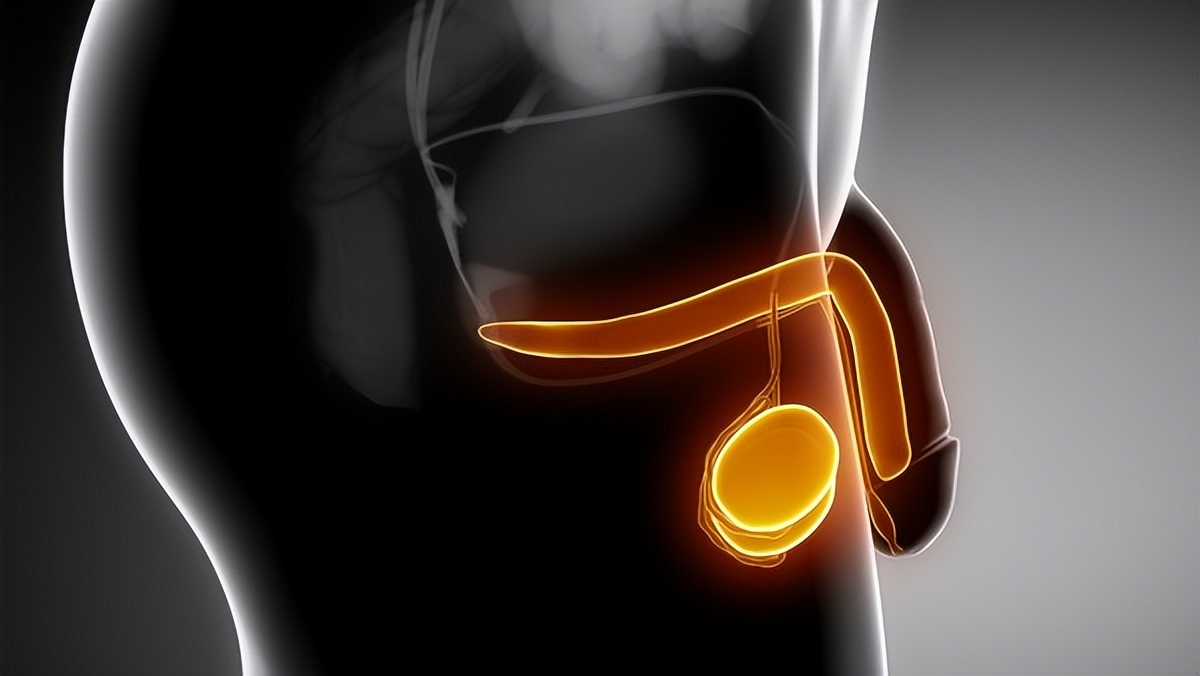 睾丸,睾丸扭转什么导致的