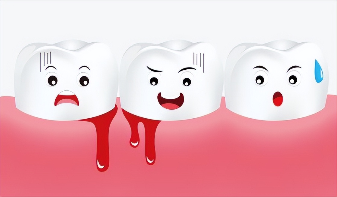 洁齿冲牙器测评,超声波冲牙洁牙器测评