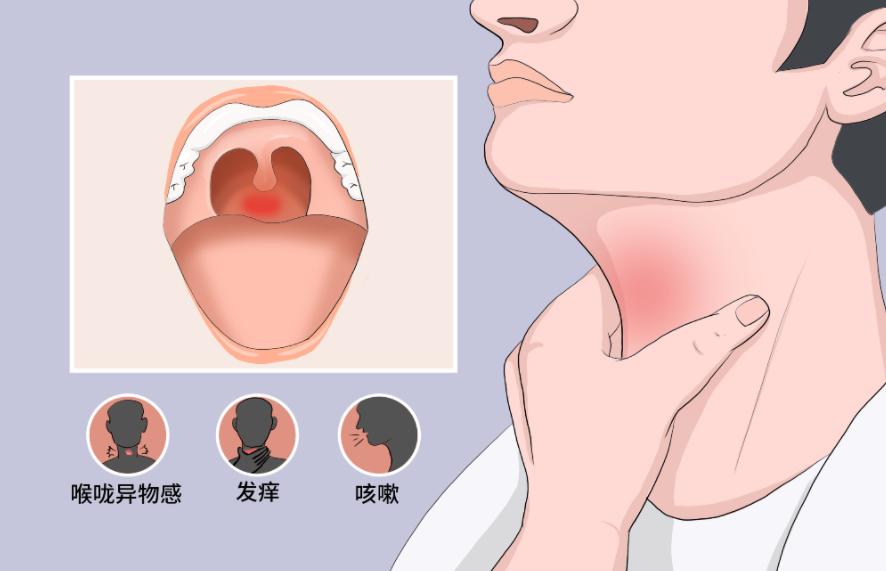 防风通圣丸治感冒效果好啊,中成药防风通圣丸的主治功能