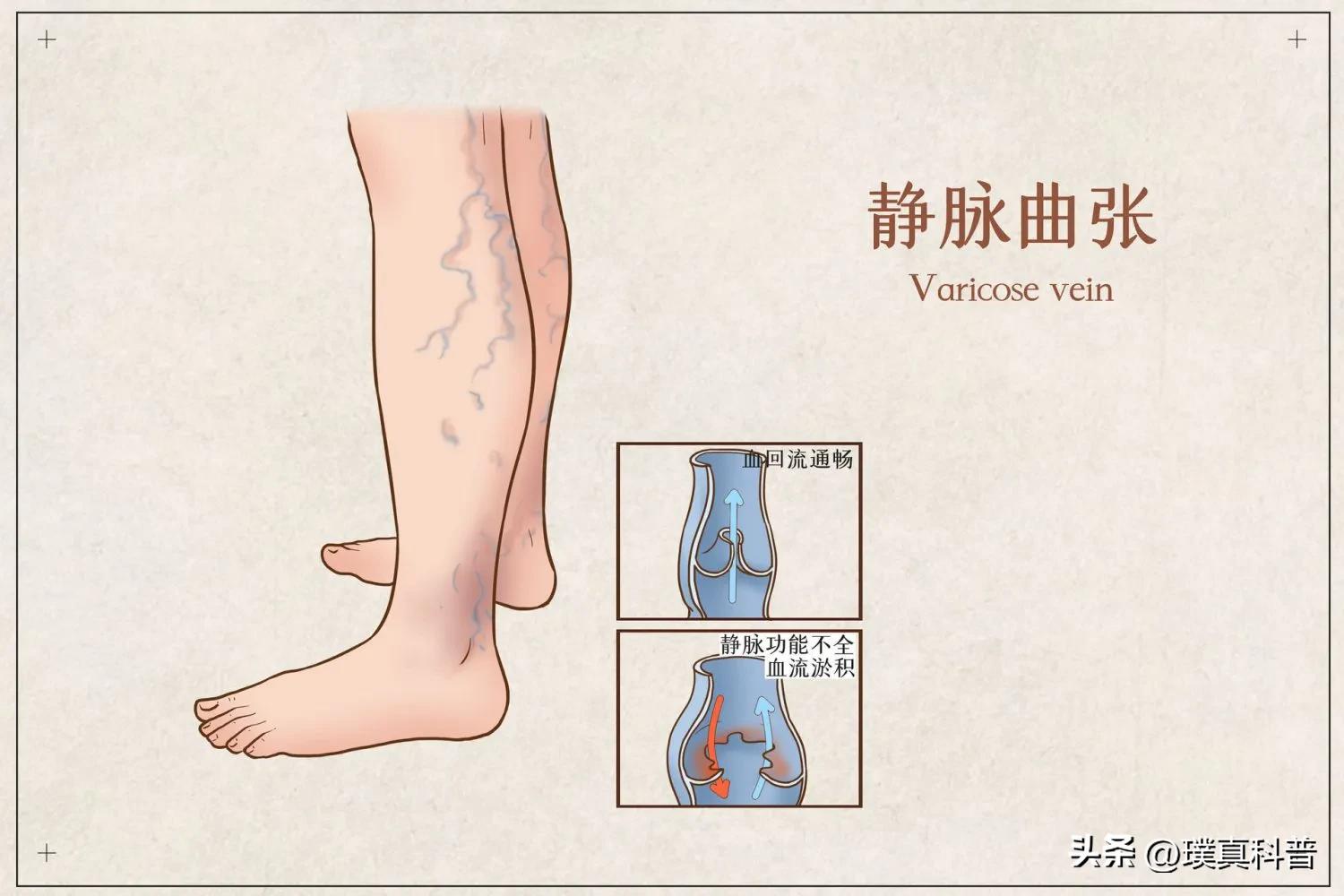 长期站着上班有什么方法缓解危害,长期久站有什么危害