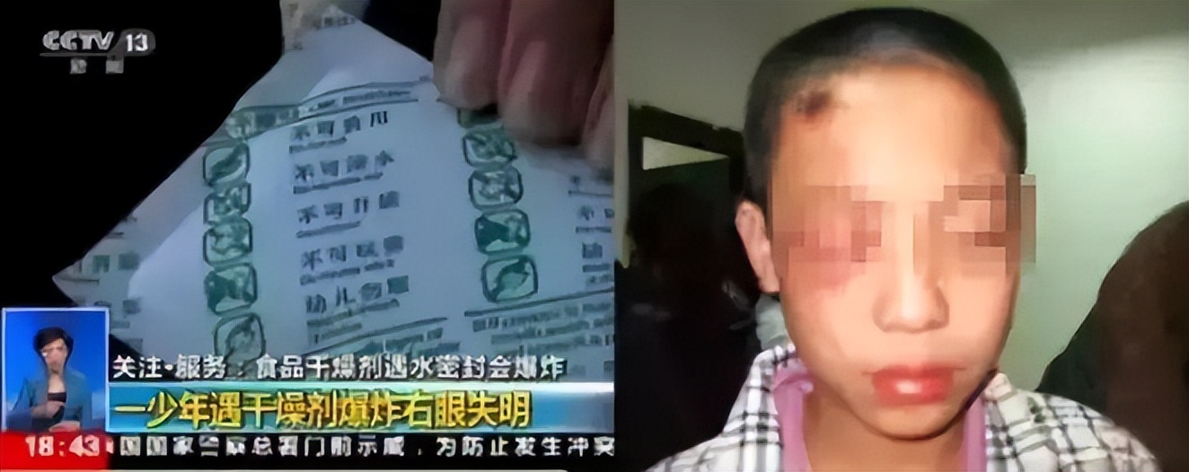 八岁男孩眼球被溶解,20分钟孩子眼球溶化无力回天