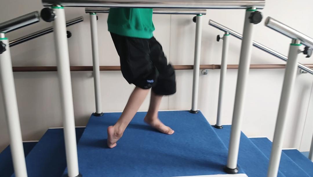 没有外科治疗的参与，可以彻底解决脑瘫的病情进展吗？