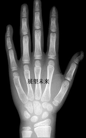 儿科医生专家免费咨询骨龄,儿科医生都会看骨龄吗