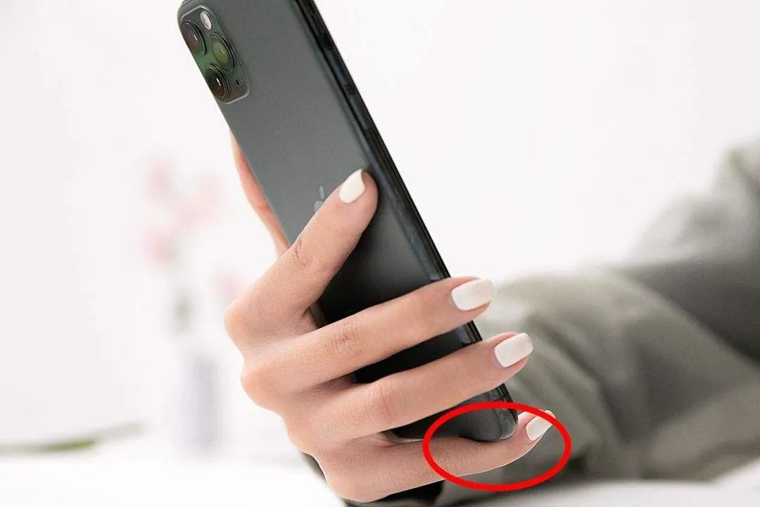 玩手机时间长了小拇指变形,玩手机小拇指变形