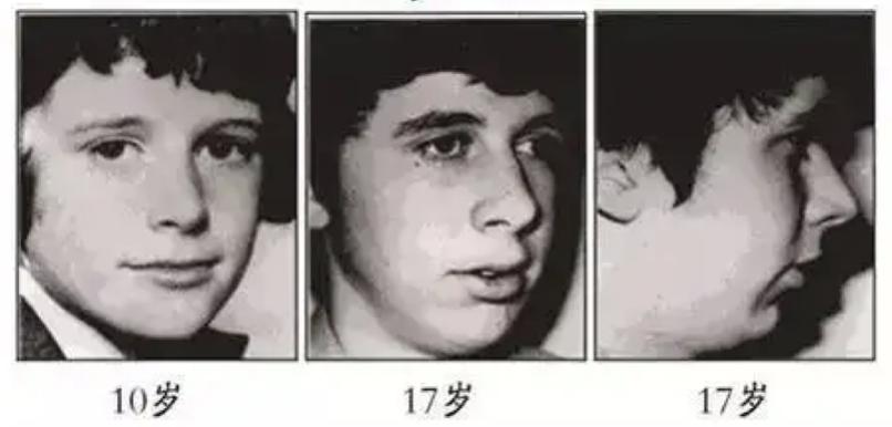 发腮显老,比变老更可怕的是体态崩了