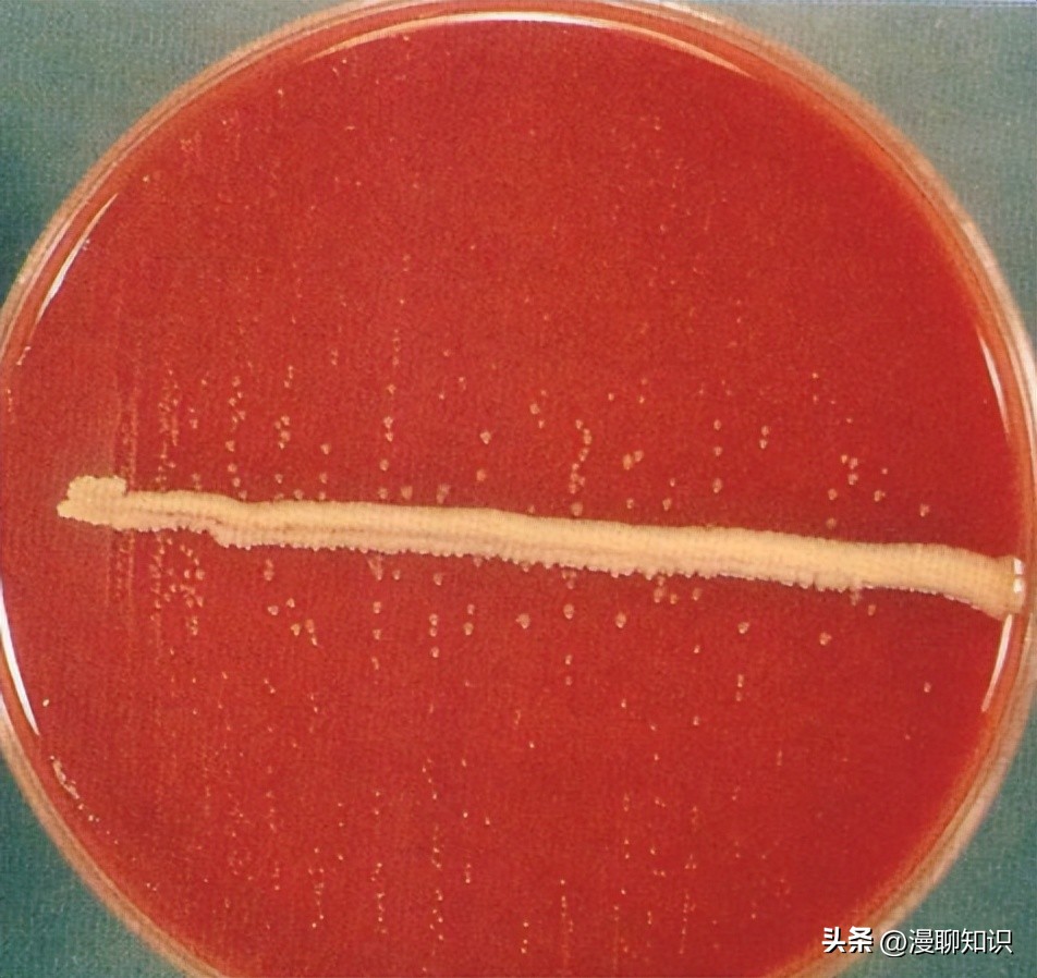 副猪嗜血杆菌是一种巴氏杆菌，其生长依赖于V因子，还有其他的吗