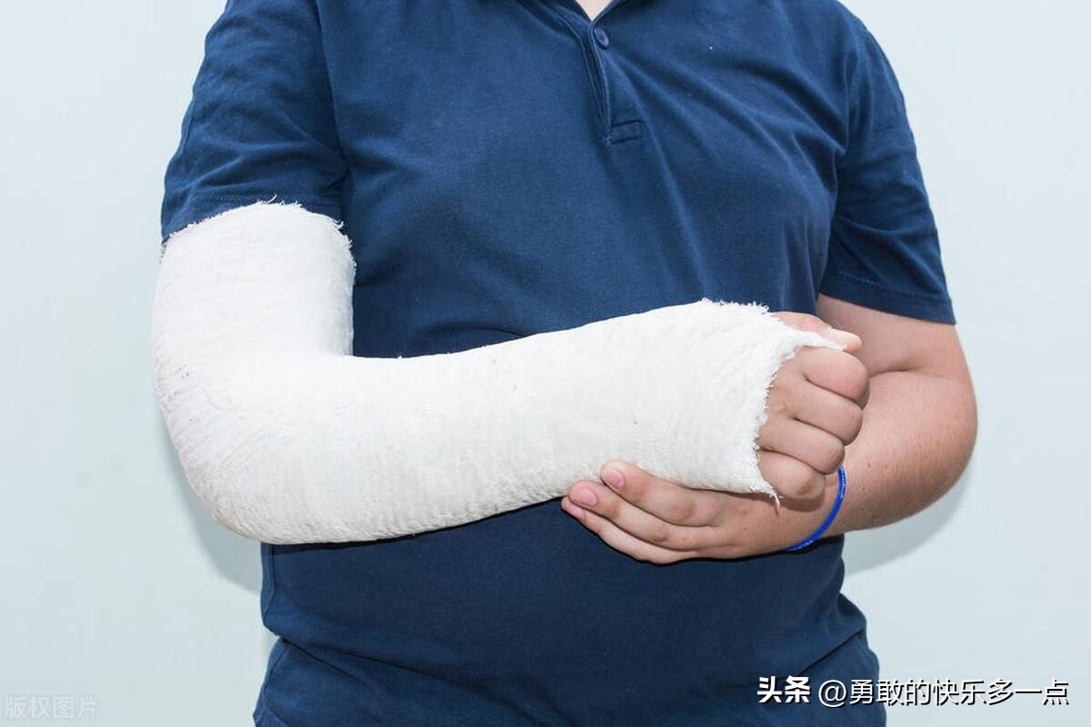 肱骨髁上骨折在家怎么训练,肱骨髁上骨折必须手术吗