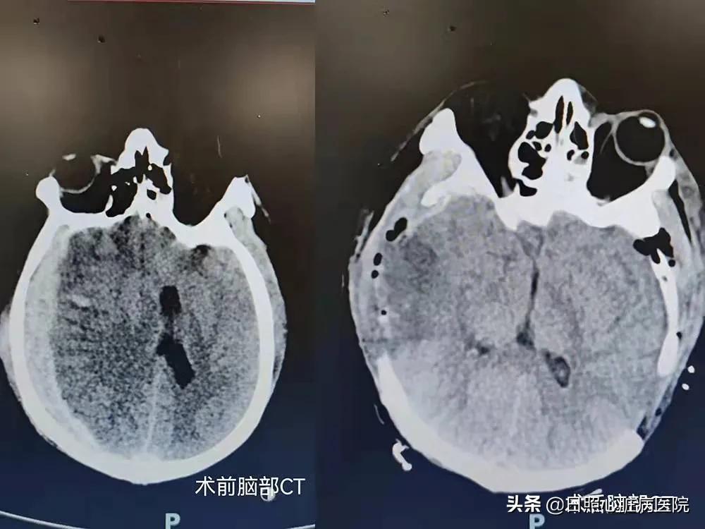 日照心脏病医院成功救治重病患儿,日照心外科医院