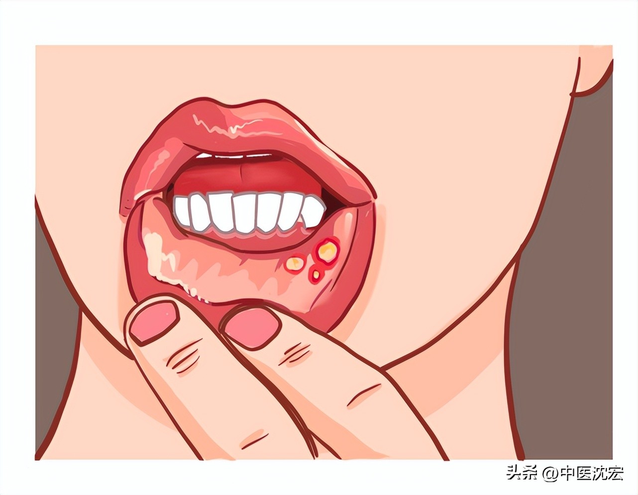 药店的牛黄解毒片怎么样,牛黄解毒片一点用没有