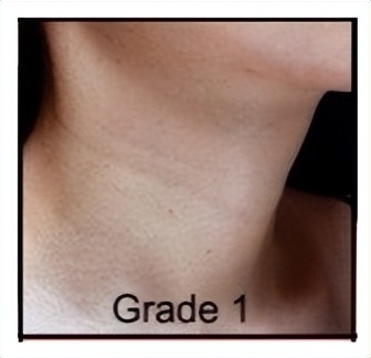 不要让颈纹出卖了你的年纪,不要让颈纹出卖你的年纪