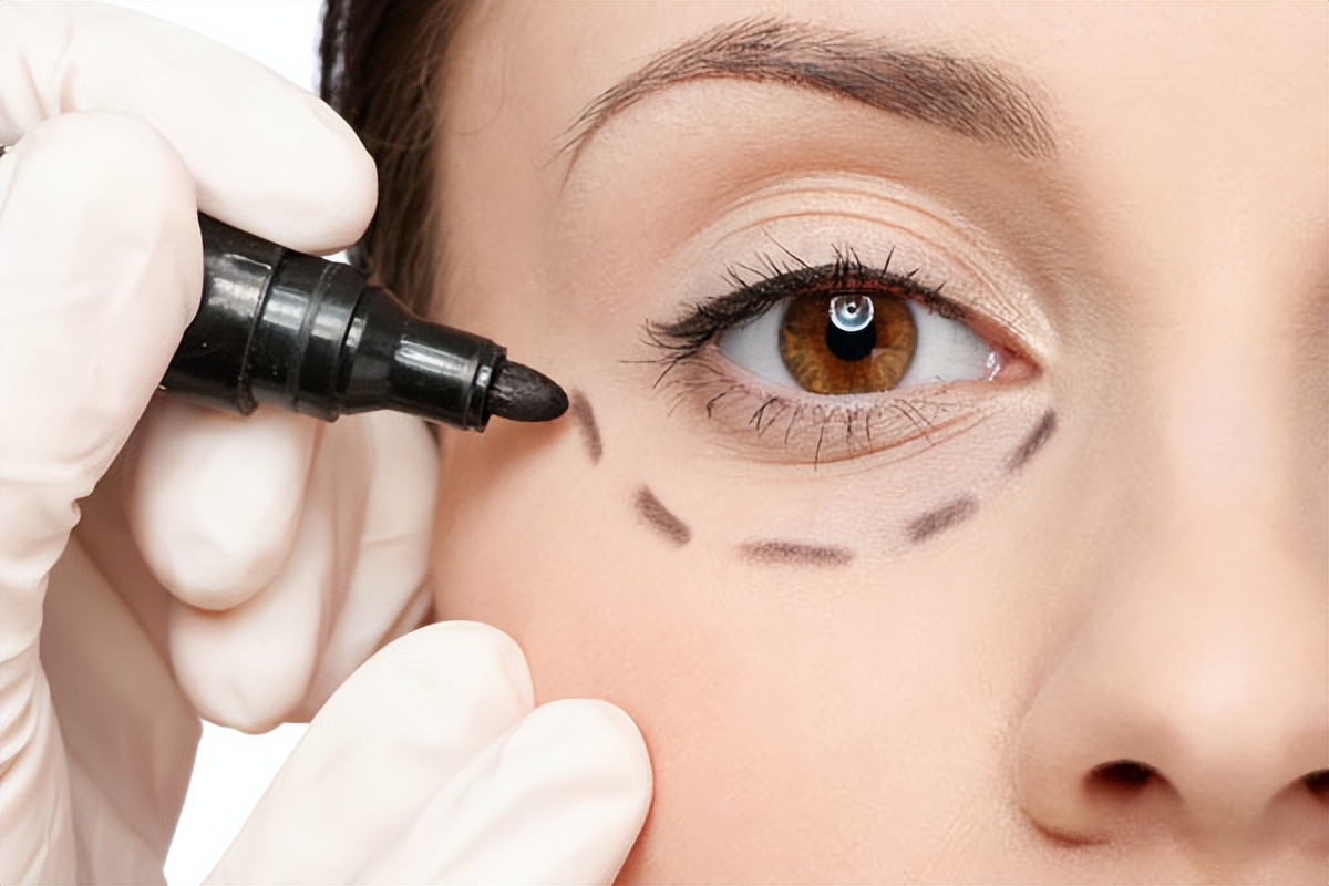 如果黑眼圈与眼袋太重怎么自救,黑眼圈自救神器